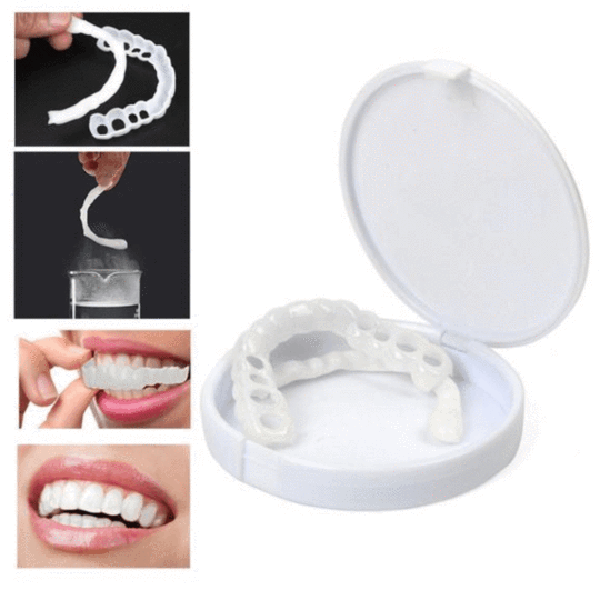 Perfect Smile Snap-On Braces